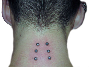 Piercing und Schmuck-Implantate